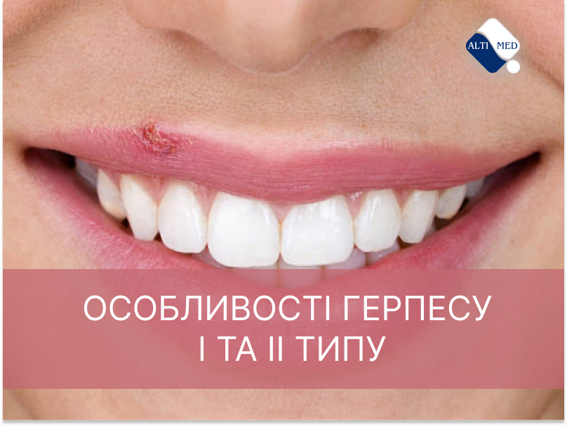 Особливості герпесу І та ІІ типу