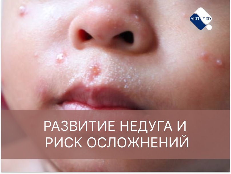 Развитие недуга и риск осложнений