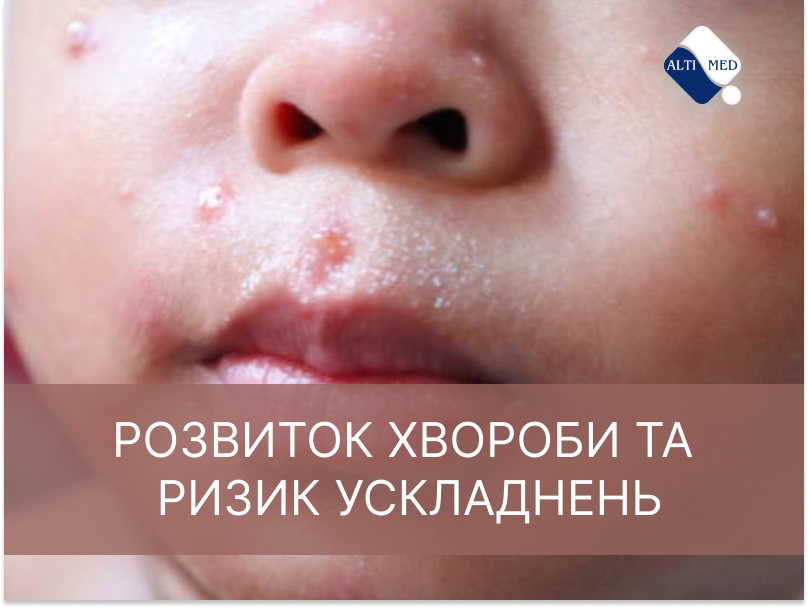 Розвиток хвороби та ризик ускладнень