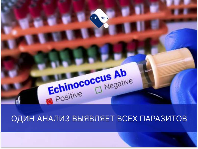 Міф №7. Один аналіз виявляє всіх паразитів